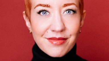 Talk hair loss