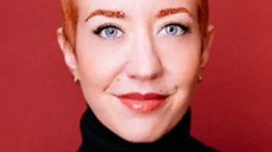 Talk hair loss